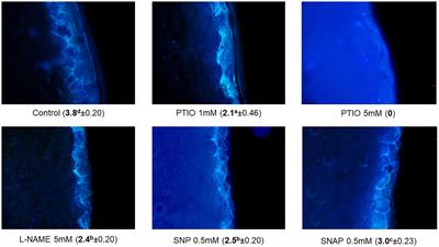 Modulatory role of nitric oxide in wound healing of potato tubers